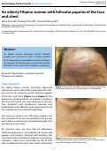 Cover page: An elderly Filipino woman with follicular papules of the face and chest