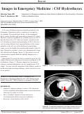 Cover page: Images in Emergency Medicine : CSF Hydrothorax