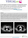 Cover page: Aortic Dissection involving the aortic root, left common carotid artery, and iliac arteries