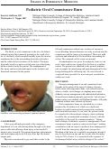 Cover page: Pediatric Oral Commissure Burn