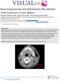 Cover page: Necrotizing Fasciitis and Mediastinitis after Wisdom Tooth Extraction: A Case Report