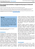 Cover page: An unusual presentation of pigmented purpuric lichenoid dermatitis
