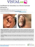 Cover page: Cauliflower Ear Secondary to a Chronic Auricular Hematoma