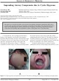 Cover page: Impending Airway Compromise due to Cystic Hygroma