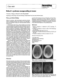 Cover page: Behçet's syndrome masquerading as tumor.