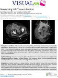 Cover page: Necrotizing Soft Tissue Infection