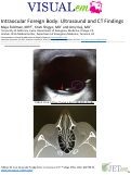 Cover page: Intraocular Foreign Body: Ultrasound and CT Findings
