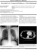 Cover page: Pericardial Cyst: Unexpected Finding on a Chest Radiograph