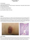 Cover page: Vegetative pyoderma gangrenosum