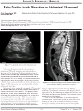 Cover page: False Positive Aortic Dissection on Abdominal Ultrasound