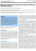 Cover page: Metastatic squamous cell carcinoma arising in the setting of folliculitis decalvans