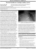 Cover page: Images in Emergency Medicine: Tension Pyothorax Causing Cardiac Arrest