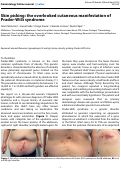 Cover page: Skin picking: the overlooked cutaneous manifestation of Prader-Willi syndrome