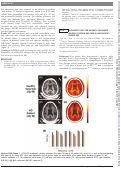 Cover page: E006 Ultrashort echo time magnetic resonance imaging of myelin and iron in Huntington’s disease (HD)