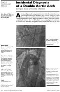 Cover page: Incidental diagnosis of a double aortic arch during an acute myocardial infarction.