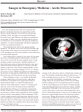 Cover page: Images in Emergency Medicine : Aortic Dissection