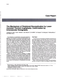 Cover page: The mechanism of peripheral recanalization by laser-assisted thermal angioplasty: confirmation by intravascular sonography.