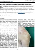 Cover page: Morphea-like lesions after treatment with ustekinumab