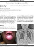 Cover page: Mal-positioned Gastrojejunostomy Tube
