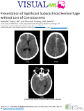 Cover page: Presentation of Significant Subarachnoid Hemorrhage without Loss of Consciousness
