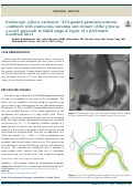 Cover page: Endoscopic pyloric exclusion—EUS-guided gastrojejunostomy combined with endoscopic suturing and closure of the pylorus: a&nbsp;novel approach to failed surgical repair of a perforated duodenal ulcer