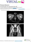 Cover page: Perianal Abscess