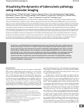 Cover page: Visualizing the dynamics of tuberculosis pathology using molecular imaging