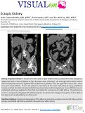 Cover page: Ectopic Kidney