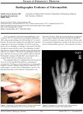 Cover page: Radiographic Evidence of Osteomyelitis