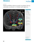 Cover page: Globus pallidus internus activity increases during voluntary movement in children with dystonia.