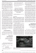 Cover page: Ultrasound Evaluation Rules Out a Suspected Hematoma After Continuous Infraclavicular Brachial Plexus Block