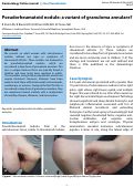Cover page: Pseudorheumatoid nodule: a variant of granuloma annulare?