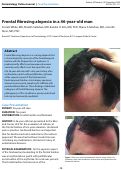 Cover page: Frontal fibrosing alopecia in a 46-year-old man