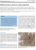 Cover page: Multifocal primary cutaneous nodular amyloidosis