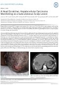 Cover page: A Head Scratcher: Hepatocellular Carcinoma Manifesting as a Subcutaneous Scalp Lesion