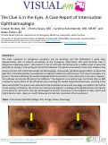 Cover page: The Clue is in the Eyes. A Case Report of Internuclear Ophthalmoplegia