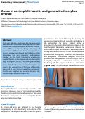 Cover page: A case of eosinophilic fasciitis and generalized morphea overlap