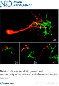 Cover page: Netrin-1 directs dendritic growth and connectivity of vertebrate central neurons in vivo