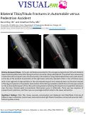 Cover page: Bilateral Tibia/Fibula Fractures in Automobile versus Pedestrian Accident