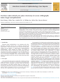 Cover page: Povidone iodine-infused pars plana vitrectomy for severe Arthrographis kalrae fungal endophthalmitis.