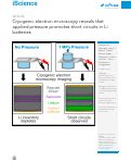 Cover page: Cryogenic electron microscopy reveals that applied pressure promotes short circuits in Li batteries