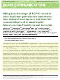 Cover page: MRI-guided histology of TDP-43 knock-in mice implicates parvalbumin interneuron loss, impaired neurogenesis and aberrant neurodevelopment in amyotrophic lateral sclerosis-frontotemporal dementia.