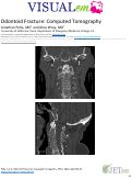 Cover page: Odontoid Fracture: Computed Tomography