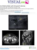 Cover page: An Elderly Male with Amyand’s Hernia