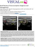 Cover page: Brief Review of Intussusception Diagnosis and Management