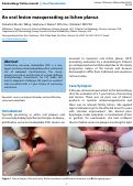 Cover page: An oral lesion masquerading as lichen planus