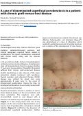 Cover page: A case of disseminated superficial porokeratosis in a patient with chronic graft-versus-host disease
