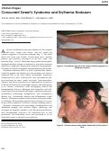 Cover page: Concurrent Sweet’s Syndrome and Erythema Nodosum