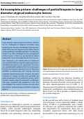 Cover page: An incomplete picture: challenges of partial biopsies in large diameter atypical melanocytic lesions