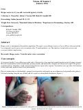 Cover page: Herpes zoster in a 2-year-old vaccinated against varicella